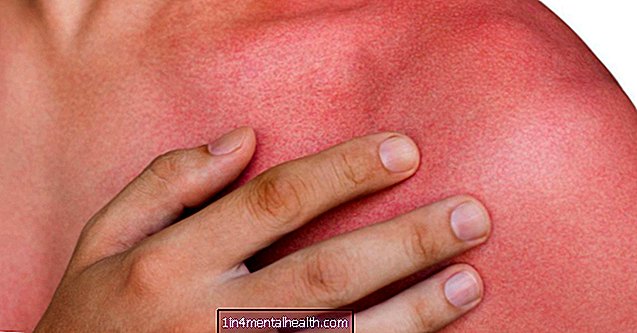 Was kann rote Haut verursachen? - Allergie