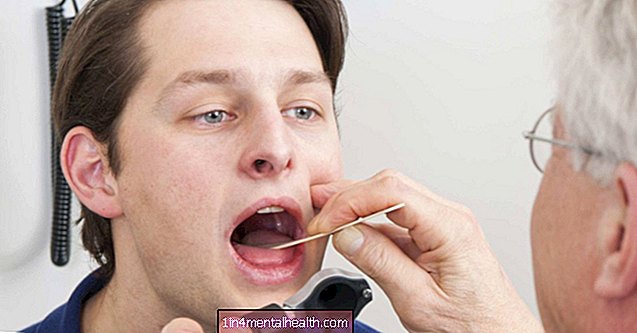 Qué saber sobre la picazón en la boca - alergia