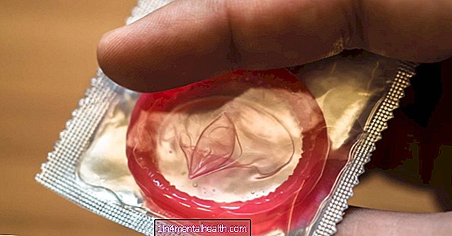 Mitä tietää kondomeista ja allergioista