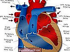 ¿Qué es el bloqueo cardíaco? - arritmia