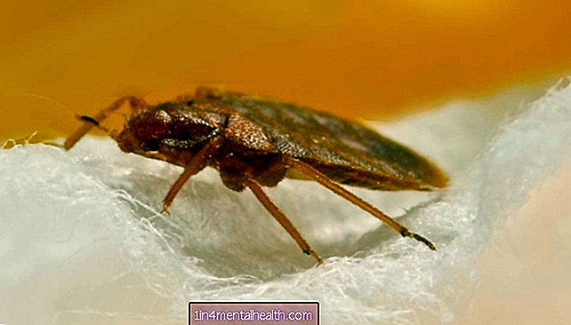 Cómo identificar las picaduras de pulgas y las picaduras de chinches - mordeduras y picaduras