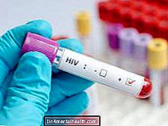 VIH vs. SIDA: ¿Cuál es la diferencia? - sangre - hematología