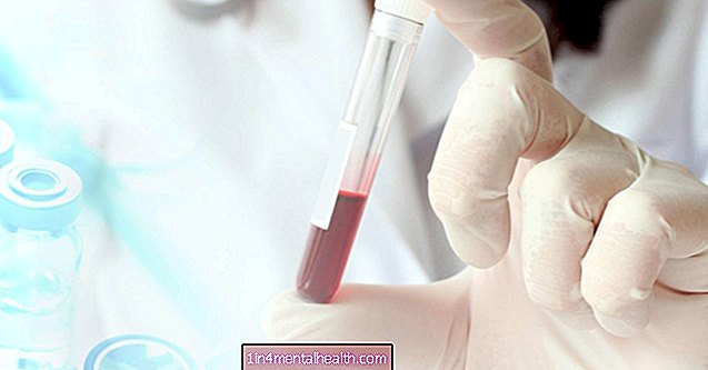 Mitä epänormaalit ALP-tasot tarkoittavat? - veri - hematologia