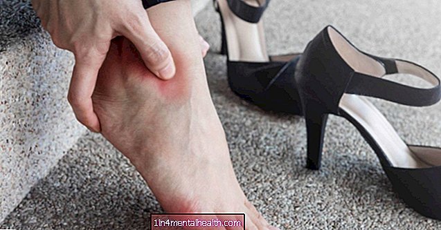 Ko darīt ar papēža sāpēm