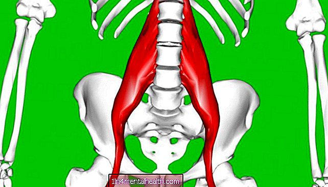 엉덩이 굴근 긴장에 대해 알아야 할 모든 것 - 뼈-정형 외과