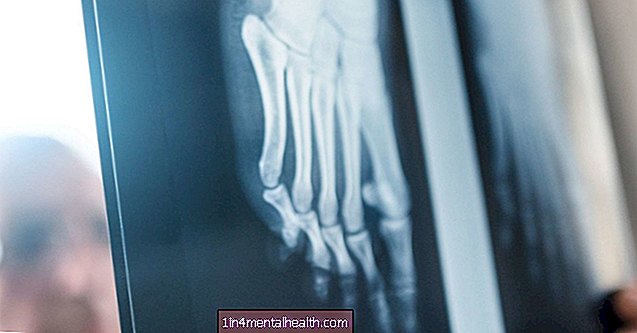 tulang - ortopedik - Tulang kaki: Semua yang perlu anda ketahui