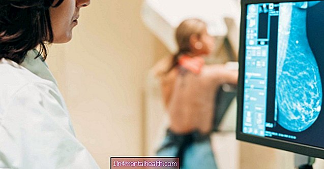 Was Sie über 3D-Mammogramme wissen sollten - Brustkrebs