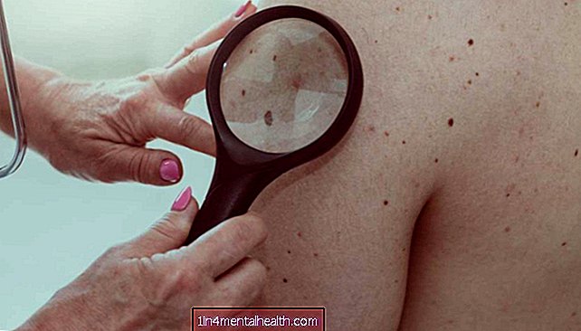 Esošā antibiotika varētu palīdzēt ārstēt melanomu