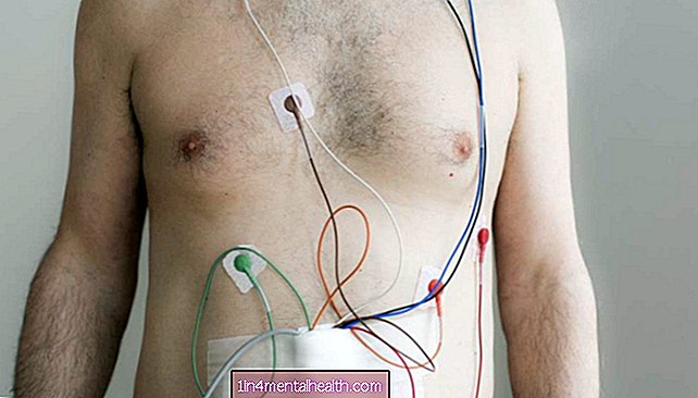 Monitorizare Holter 24 de ore: Ce să știți - cardiovascular - cardiologie