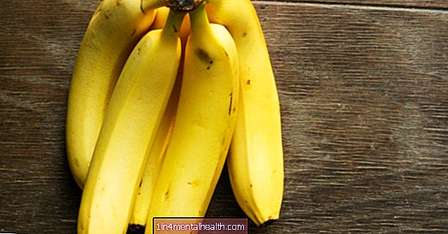¿Pueden los plátanos ayudarte a perder peso? - colesterol
