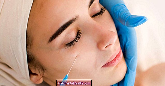 Kas saate Botoxi kasutada oma silmade all? - kosmeetika-meditsiin - plastiline kirurgia