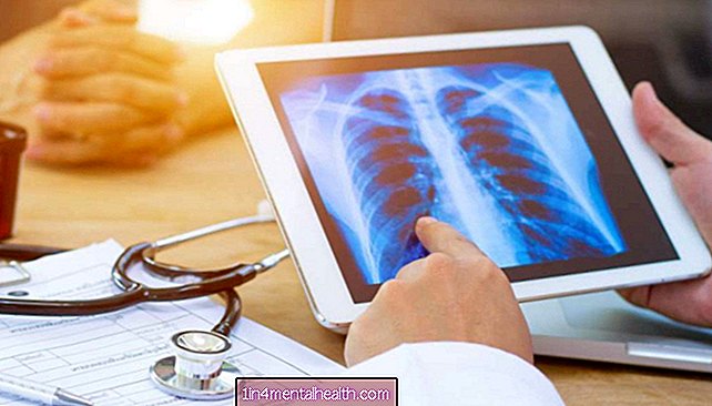Sistik Fibrosis - Fibrosis kistik: Ubat yang ada dapat meningkatkan fungsi paru-paru