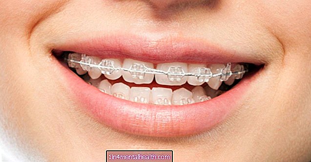 ¿Cómo puede ayudar el tratamiento de ortodoncia? - odontología