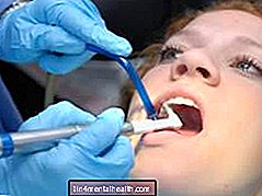 Hvordan vet du om du har en sprukket tann? - tannbehandling