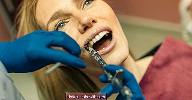 무감각은 치과 의사 후 얼마나 오래 지속됩니까? - 치과