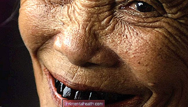 ¿Qué causa que los dientes se pongan negros? - odontología