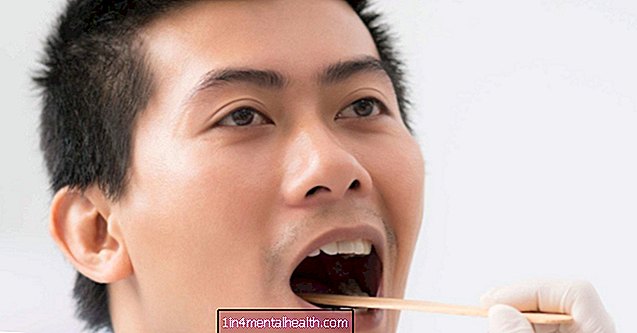 Miksi kieleni vuotaa? - hammaslääketiede