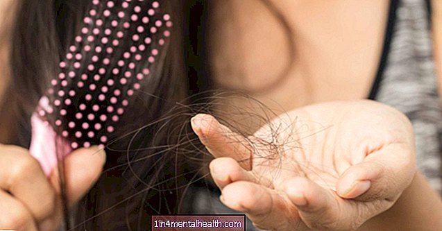 ŽIV ir plaukų slinkimas: kokia nuoroda?