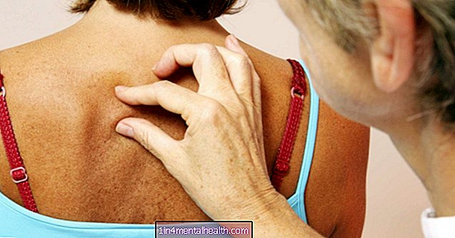 Що викликає тверду грудку під шкірою?