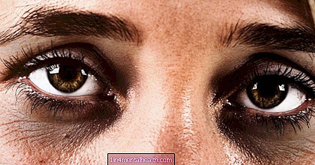 Ce cauzează cearcănele sub ochi? - dermatologie