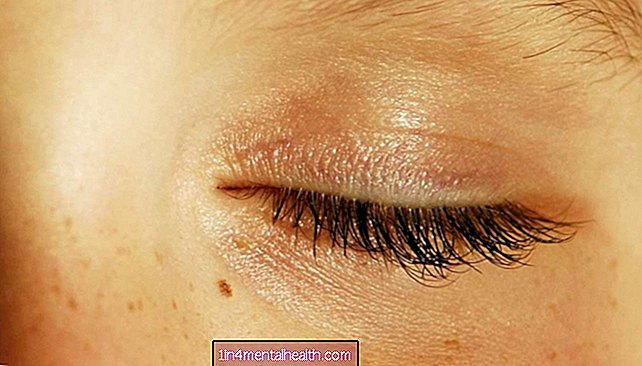 Једанаест узрока бола при трептању - суво око