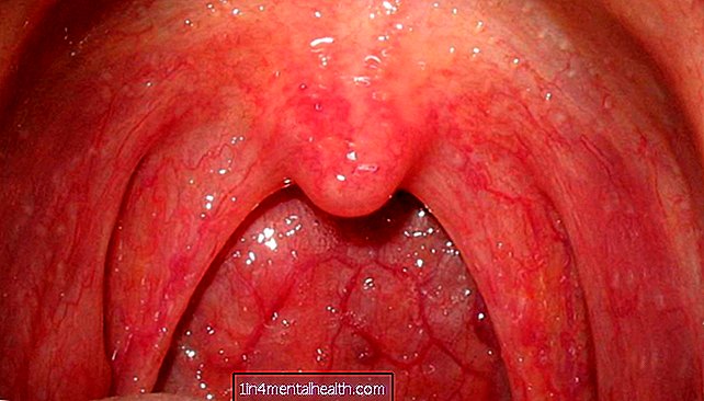 Ce cauzează umflături în partea din spate a gâtului?