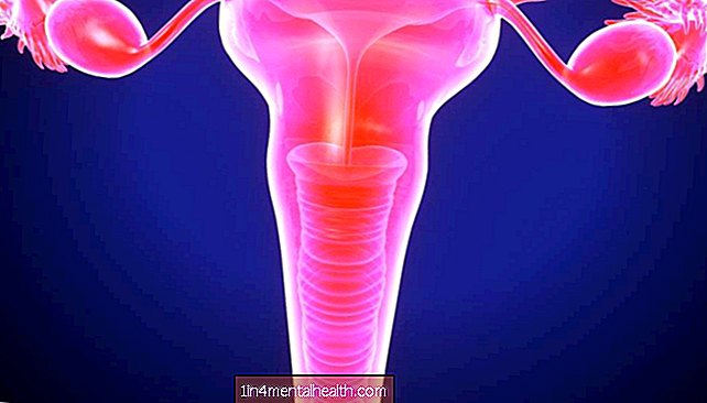 endometriozis - Servikal endometriozis nedir?