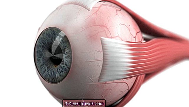 ¿Qué hay que saber sobre la enfermedad de Devic? - salud ocular - ceguera
