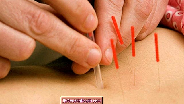 Kan akupunktur forbedre fertiliteten?