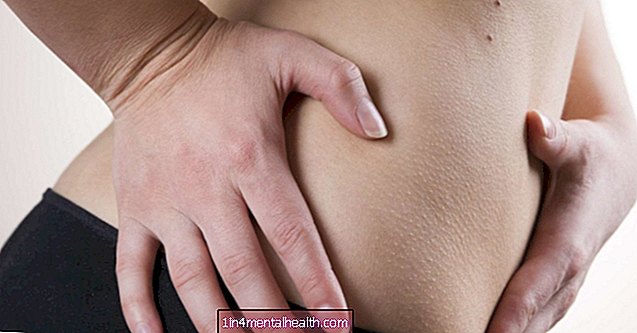 Какав је то бол у доњем десном делу стомака? - гастроинтестинални - гастроентерологија