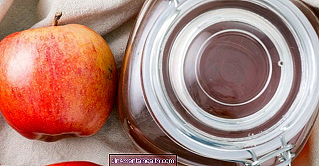 Oțetul de mere poate trata guta? - gută