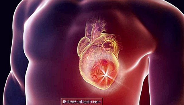 Medicamento para la gota podría ayudar a tratar la insuficiencia cardíaca - gota