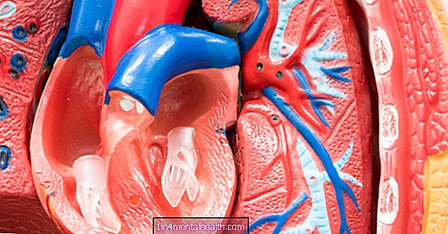 ¿Qué sucede durante la fibrilación auricular? - enfermedad del corazón