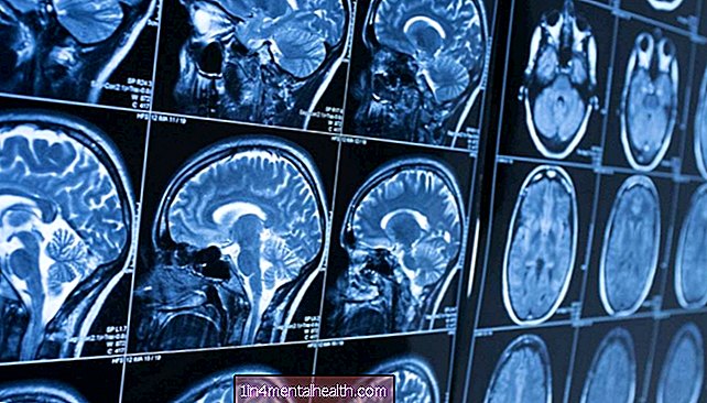 Uus lähenemisviis võib päästa ajurakke neurodegeneratiivsete haiguste korral - hunttons-haigus