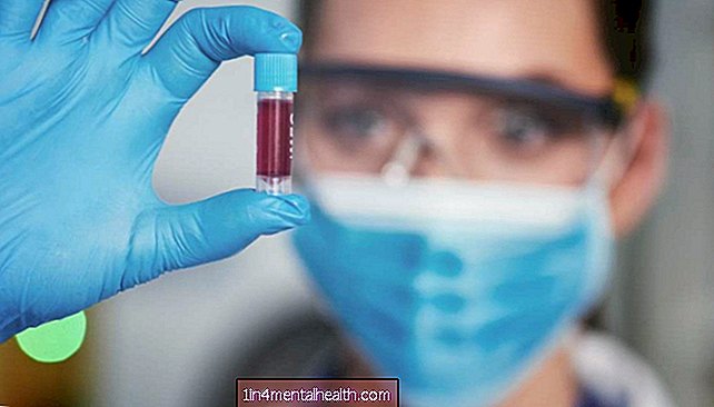 El descubrimiento de células madre podría mejorar los tratamientos para la leucemia y otras enfermedades - leucemia