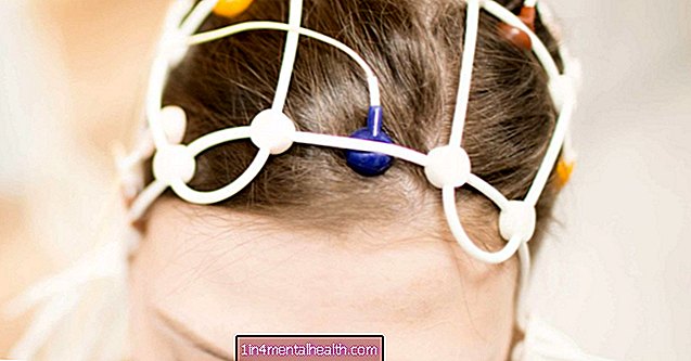 Mida peaks teadma EEG testide kohta - meditsiiniseadmed - diagnostika