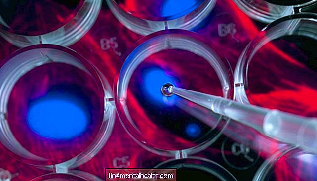 Unternehmen, die riskante Stammzellprodukte verkaufen, erhalten eine FDA-Warnung - medizinische Innovation