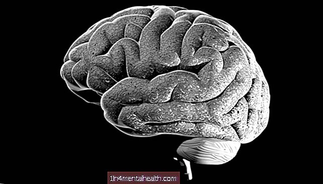 A estrutura do cérebro pode desempenhar um papel fundamental na psicose