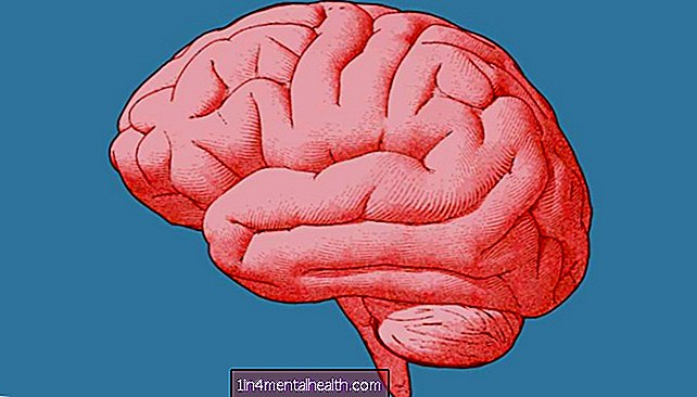 Стимулирането на мозъка с ултразвук може да повлияе на решенията - mri - домашен любимец - ултразвук