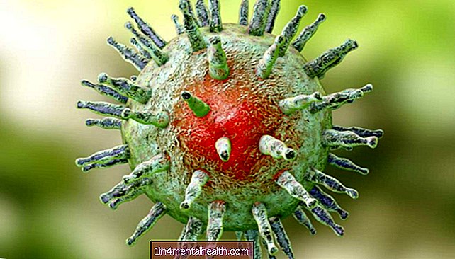 MS : 일반적인 헤르페스 바이러스 변종이 위험을 높입니다