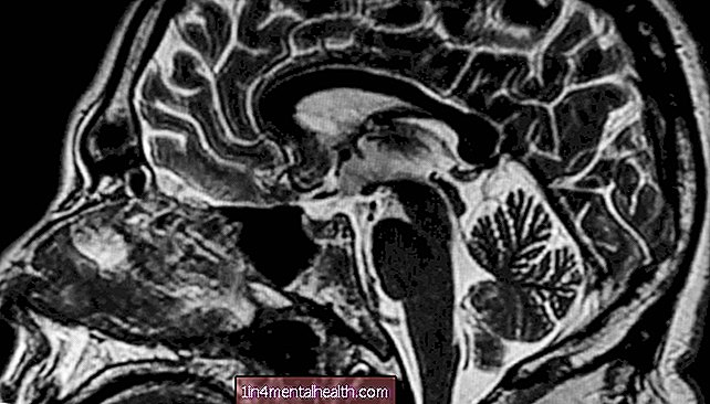 Проучване на невроанатомията на убиец - неврология - неврология