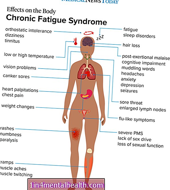 Mida teada kroonilise väsimussündroomi kohta - neuroloogia - neuroteadus