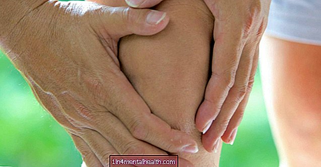 ¿Puede tener brotes de osteoartritis? - osteoartritis