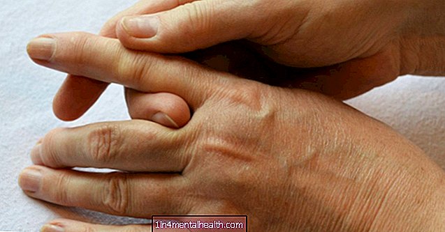 Jäikate sõrmede põhjused ja ravimeetodid - artroos