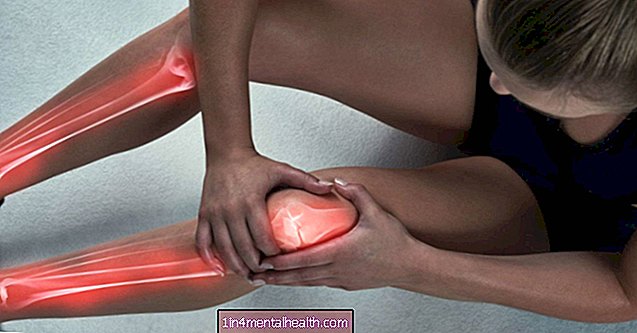 ¿Qué podría causar dolor de huesos? - osteoartritis