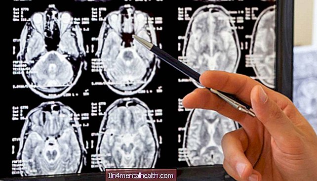 Cerebral ødem: Alt du trenger å vite - hjerneslag