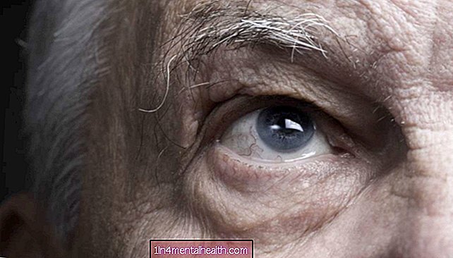Accident vascular cerebral: Reconectarea conexiunii ochi-creier poate restabili vederea