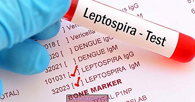 Leptospiroos: mida peate teadma - troopilised haigused