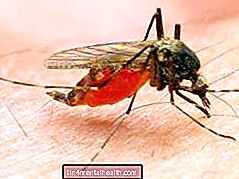 Mida teada malaariast - troopilised haigused