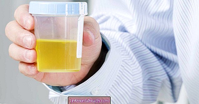 Celulele epiteliale din urină: ce înseamnă? - infecții ale tractului urinar